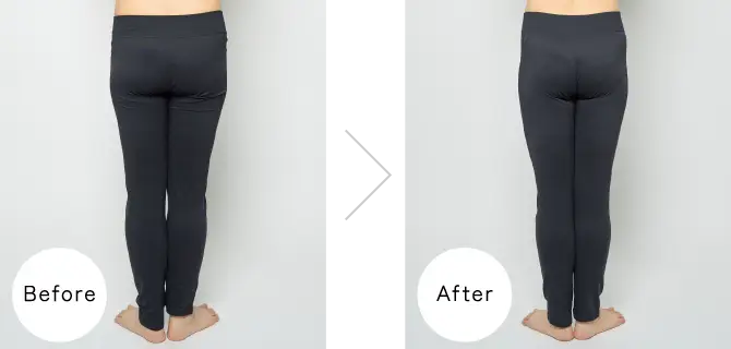 Before／After。※ヒップトーン未使用時と使用直後（ノーマルモード10分間使用）を比較。画像加工はしていません。効果には個人差があります。