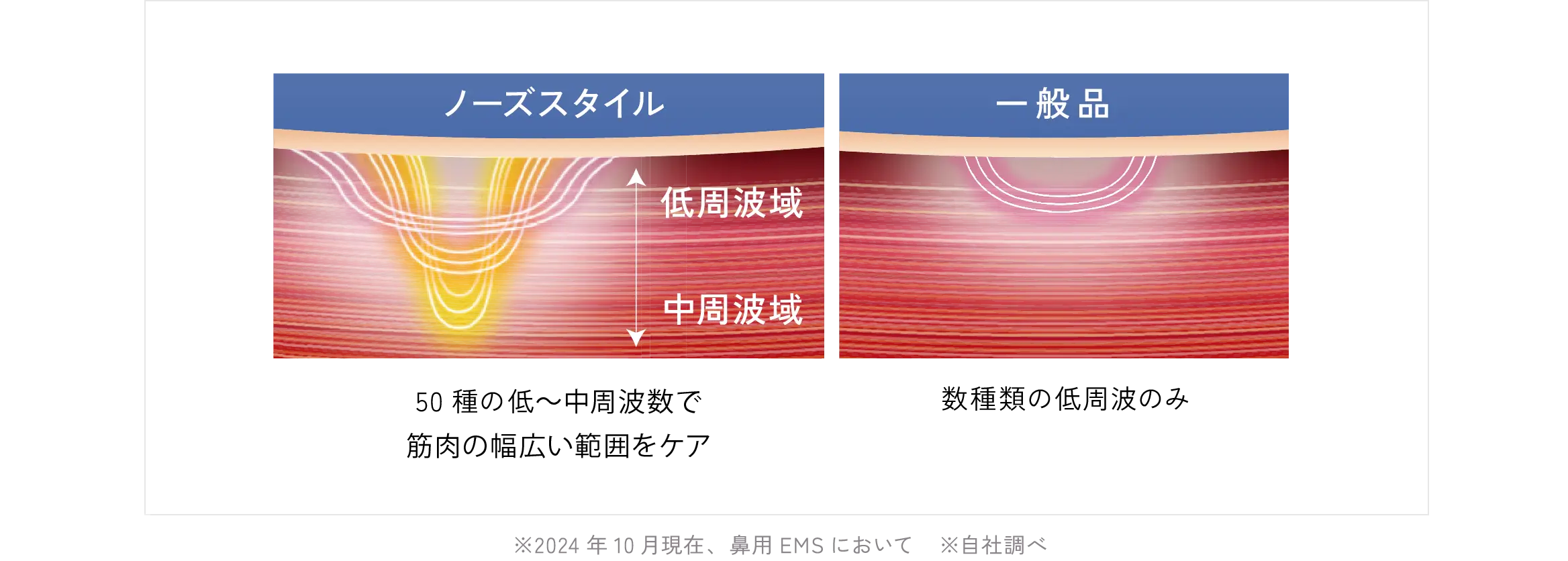 EMS市場最多※ 周波数50種類以上で効率的にアプローチ